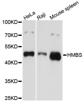 HMBS / PBGD Antibody