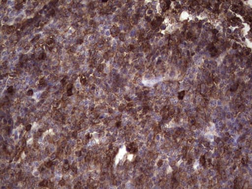 Monoclonal Mouse anti-Human ANGPTL1 Antibody (clone OTI1B2, aa24-491, IHC, WB)