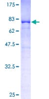 Human EIF3D Protein (Recombinant GST)