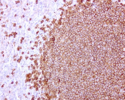 CD20 Antibody (clone UMAB38)