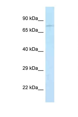 Junctophilin 2 / JPH2 Antibody (aa66-115)