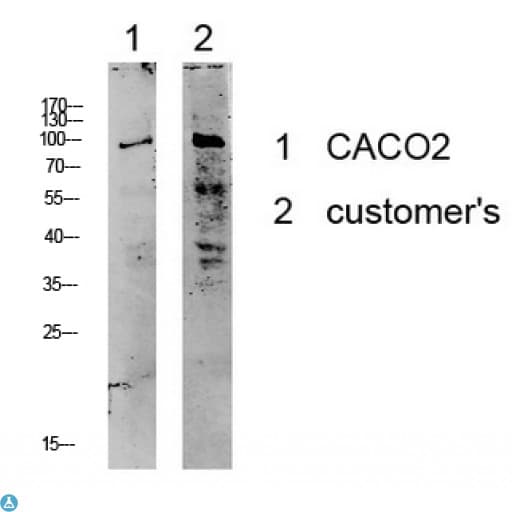 KCNB1 / Kv2.1 Antibody