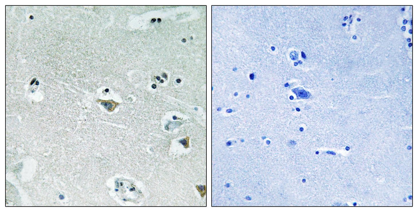 Polyclonal Rabbit anti-Human SREBF1 / SREBP-1 Antibody (phospho-Ser439, IHC, WB)
