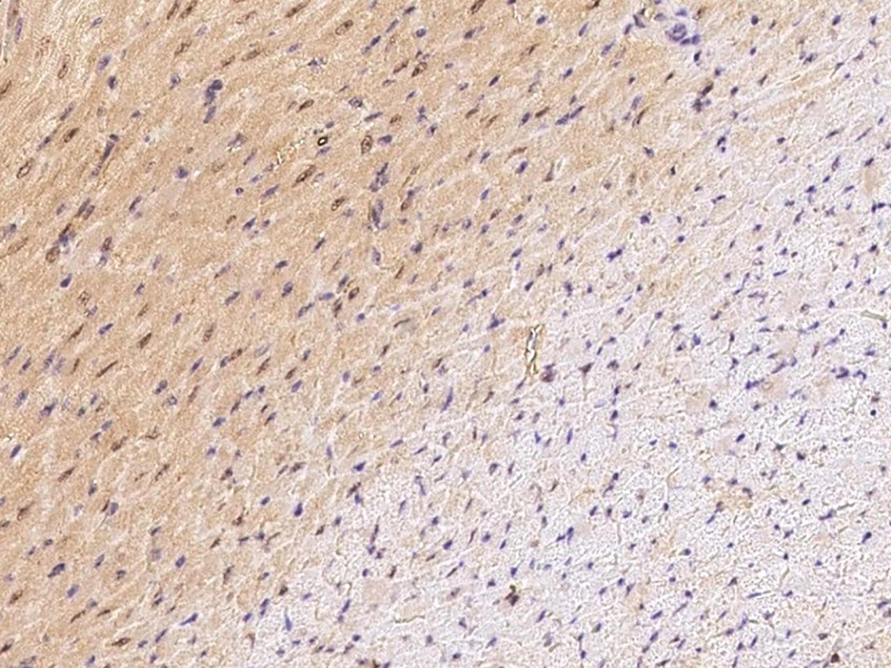 Polyclonal Rabbit anti-Mouse ERBB4 / HER4 Antibody (Preservative Free, IHC)
