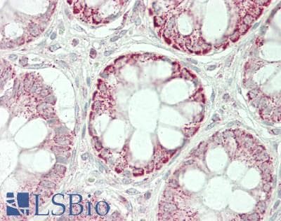 IHC-plus™ PDHA1 / PDH E1 Alpha Antibody (C-Terminus)
