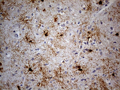 GPR17 Antibody (clone OTI9D6, Carrier-free)