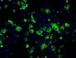 Monoclonal Mouse anti-Human FH / Fumarase / MCL Antibody (clone OTI1F10, IHC, IF, WB)