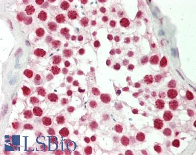 IHC-plus™ CBX3 / HP1 Gamma Antibody (aa75-125)