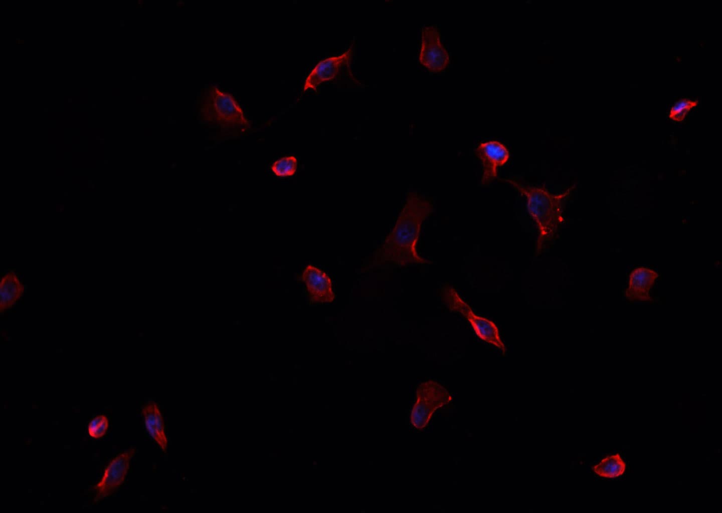 EPHA1 / EPH Receptor A1 Antibody
