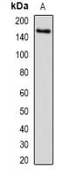 SETD5 Antibody