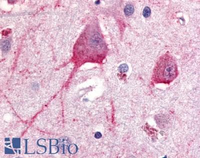 IHC-plus™ TRH Receptor / TRHR Antibody (C-Terminus)