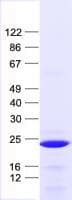 Human ASPDH Protein (Recombinant His, N-Terminal)