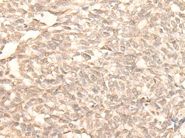 RAD23B / HR23B Antibody