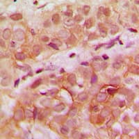 Polyclonal Rabbit anti-Human WDHD1 Antibody (Internal, IHC, WB)