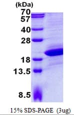 Human UXT Protein (Recombinant His)