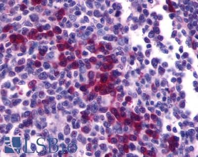 PathPlus™ CXCR4 Antibody (Cytoplasmic Domain)