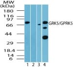 IHC-plus™ Polyclonal Rabbit anti-Human GRK5 Antibody (IHC, WB)