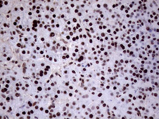 XRN2 Antibody (aa677-779, clone OTI5F4)