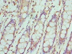 IRF4 Antibody (aa180-451)