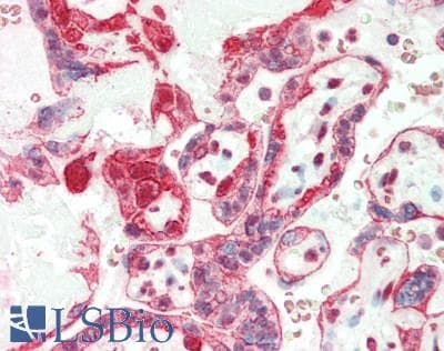 IHC-plus™ Polyclonal Rabbit anti-Human RGS1 Antibody (aa102-151, IHC, WB)