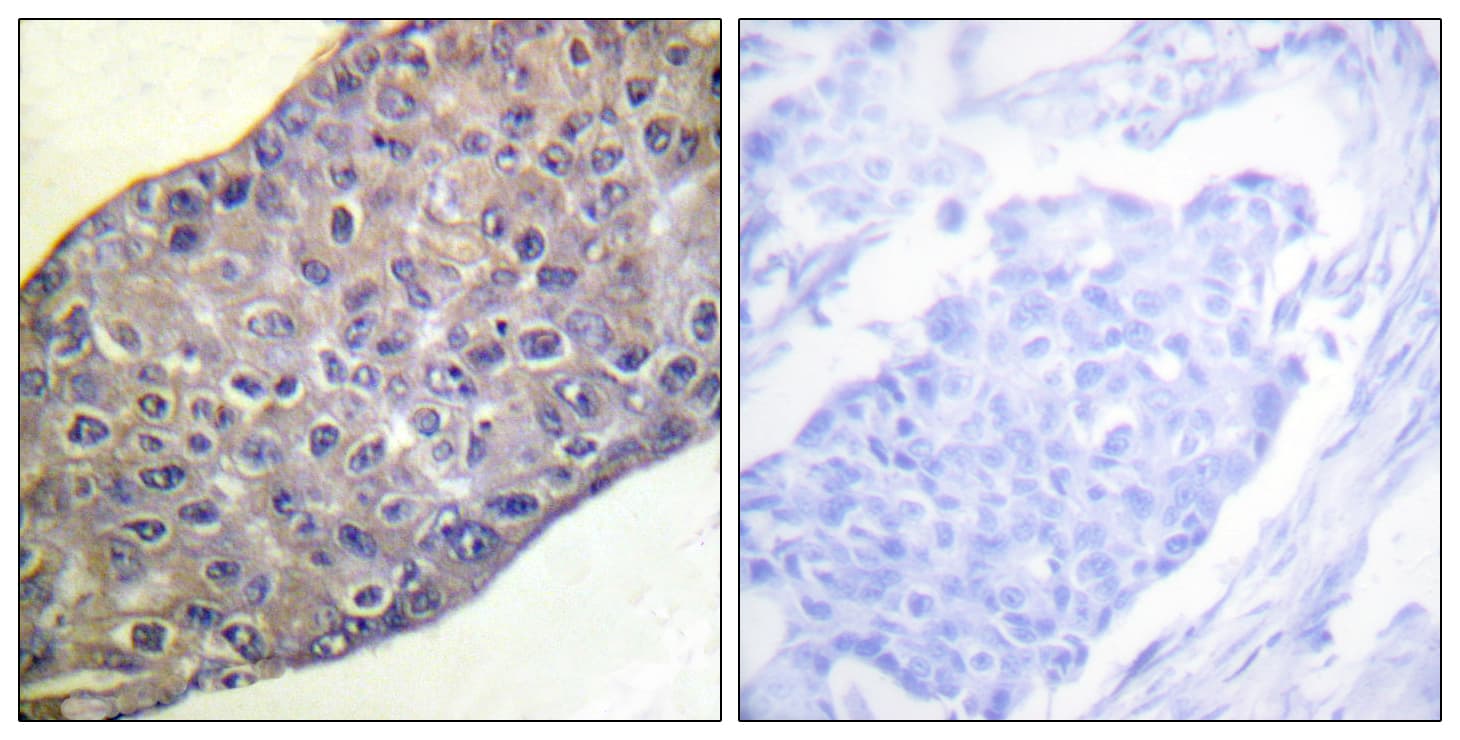 Polyclonal Rabbit anti-Human RHOA Antibody (aa144-193, IHC, WB)