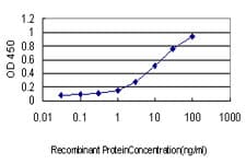 Monoclonal Mouse anti-Human PTGIR / IP Receptor Antibody (clone 4B10, WB)