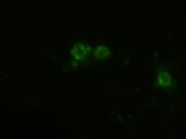 PTCH1 / Patched 1 Antibody (clone OTI3c2)
