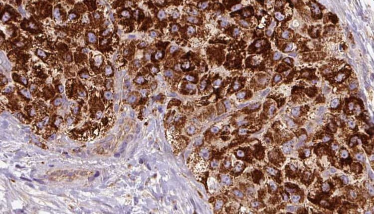 CCR3 Antibody