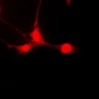 Polyclonal Rabbit anti-Human STAT5A Antibody (phospho-Ser780, IHC, IF, WB)
