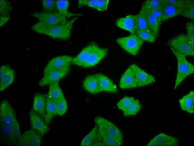 RIOK2 Antibody