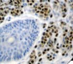 MITF Antibody (clone C5/D5, Ready-to-Use)