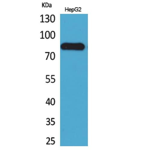 TEM1 / CD248 Antibody (331-380 aa, Internal)