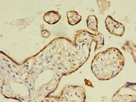 RARRES2 / Chemerin Antibody (aa21-157, Biotin)