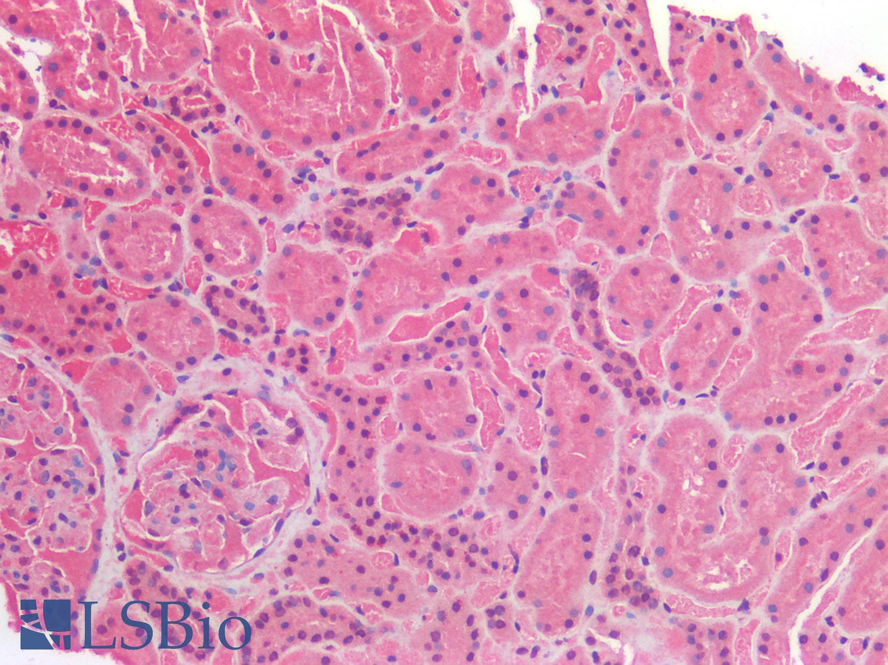 IHC-plus™ IGF1R / IGF1 Receptor Antibody