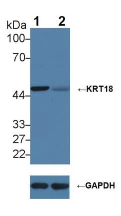 Polyclonal Rabbit anti-Human KRT18 / CK18 / Cytokeratin 18 Antibody (aa238-396, WB)