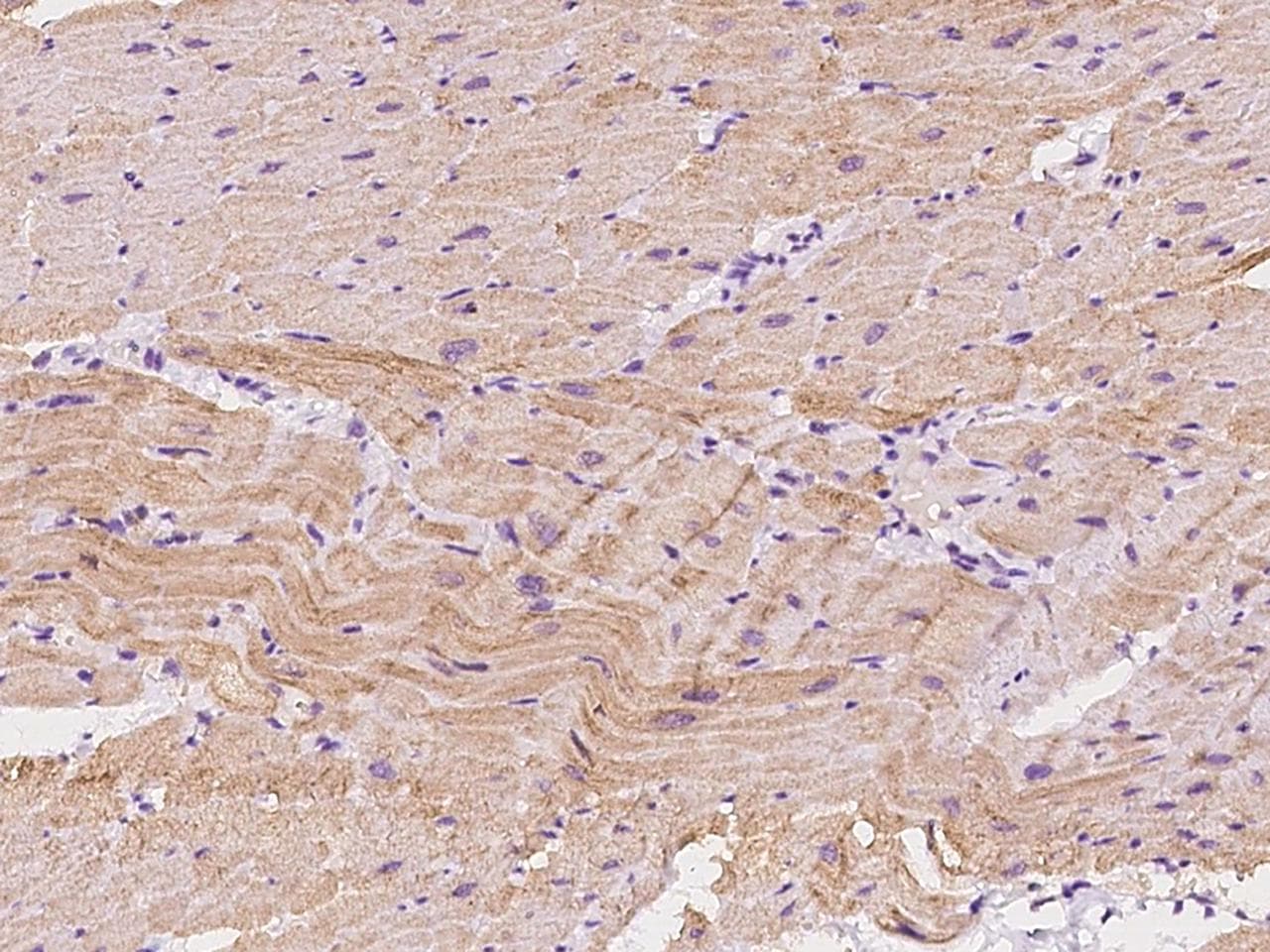 SRL / Sarcalumenin Antibody