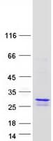 Human MGMT Protein (Recombinant Myc-DDK (Flag))