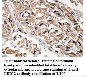 LRIG2 Antibody (aa313-502)