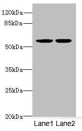 MATK Antibody
