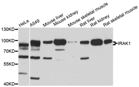 IRAK1 / IRAK Antibody
