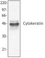 Pan Cytokeratin Antibody (clone C-11)