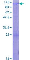 Human HIRIP3 Protein (Recombinant GST)