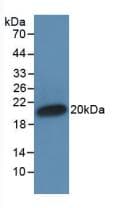 IFNA1 / Interferon Alpha 1 Antibody