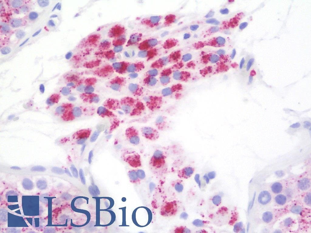 IHC-plus™ GLB1 / Beta-Galactosidase Antibody (clone 2F6)