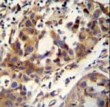Polyclonal Rabbit anti-Human CCDC17 Antibody (aa481-509, IHC, WB)