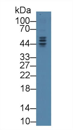 TMPO / TP / Thymopoietin Antibody (aa1-243, APC)