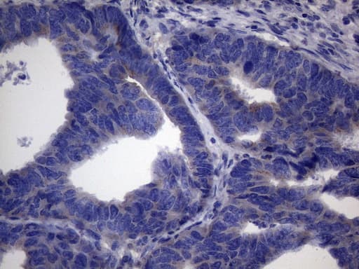CSF2 / GM-CSF Antibody (aa18-144, clone OTI6A3)