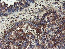 UBE2J1 Antibody (clone OTI1F6)