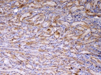 AMD / AMD1 Antibody