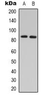Polyclonal Rabbit anti-Human ADRBK2 / GRK3 Antibody (Internal, IHC, WB)